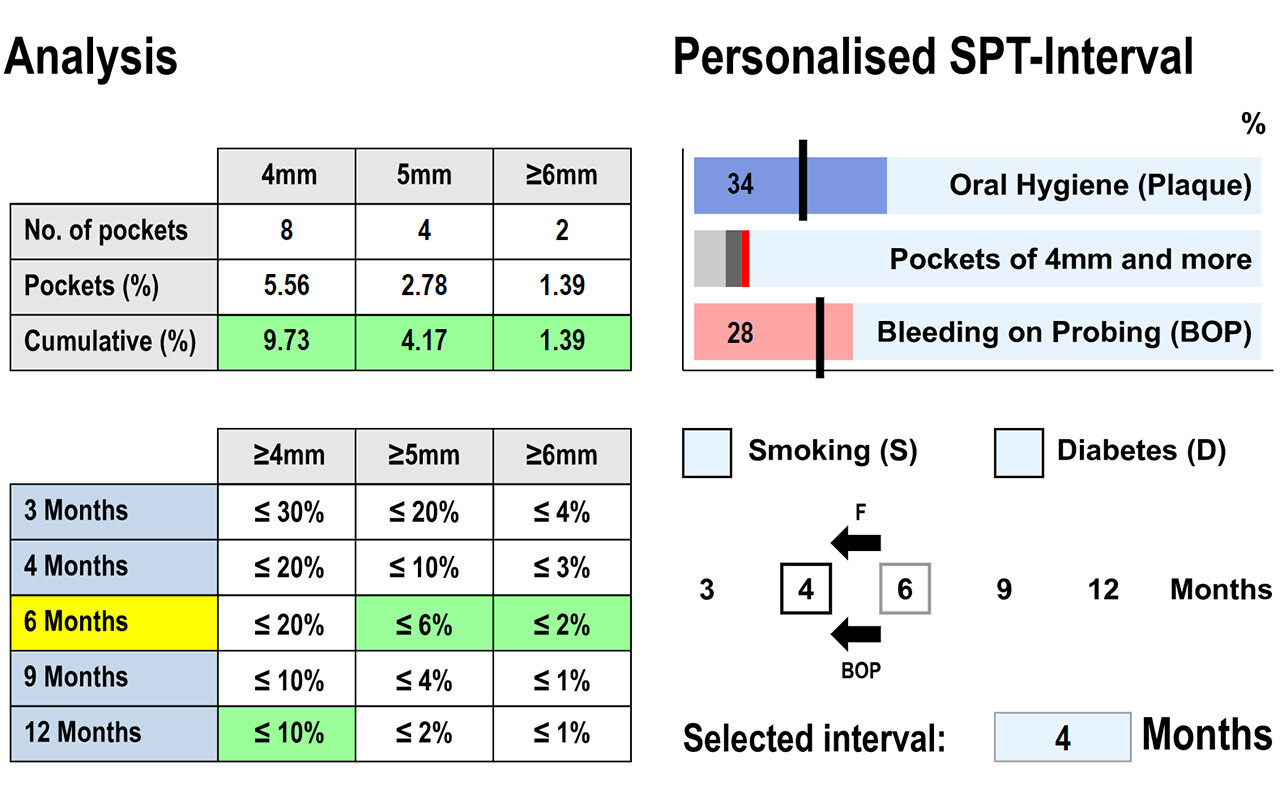 Supportive Periodontal Therapy (SPT)