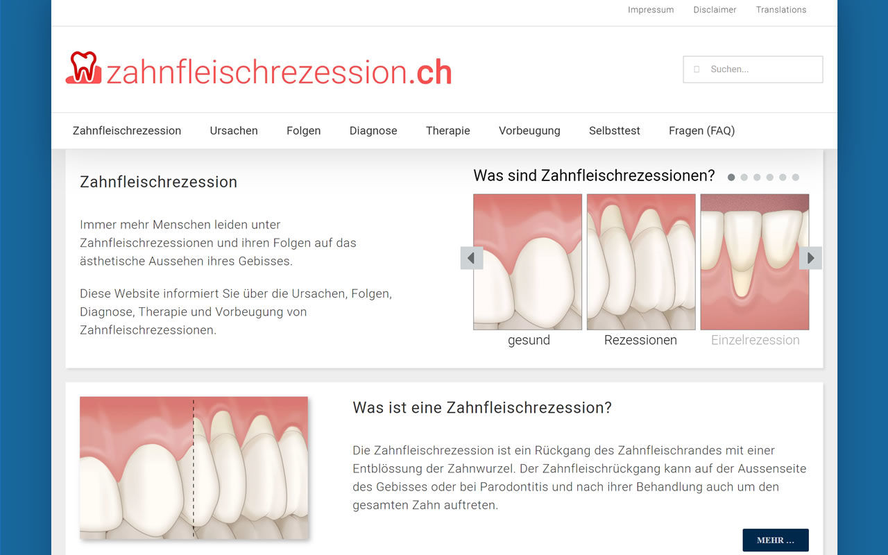 Informationen über Zahnfleischrezessionen
